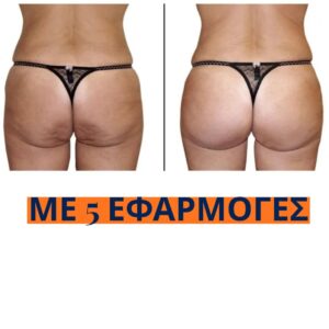 Copia di Landing Grecia (6)