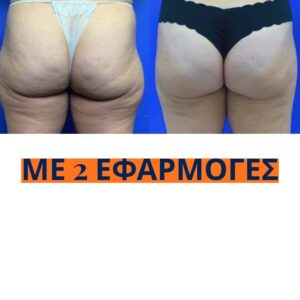 Copia di Landing Grecia (7)
