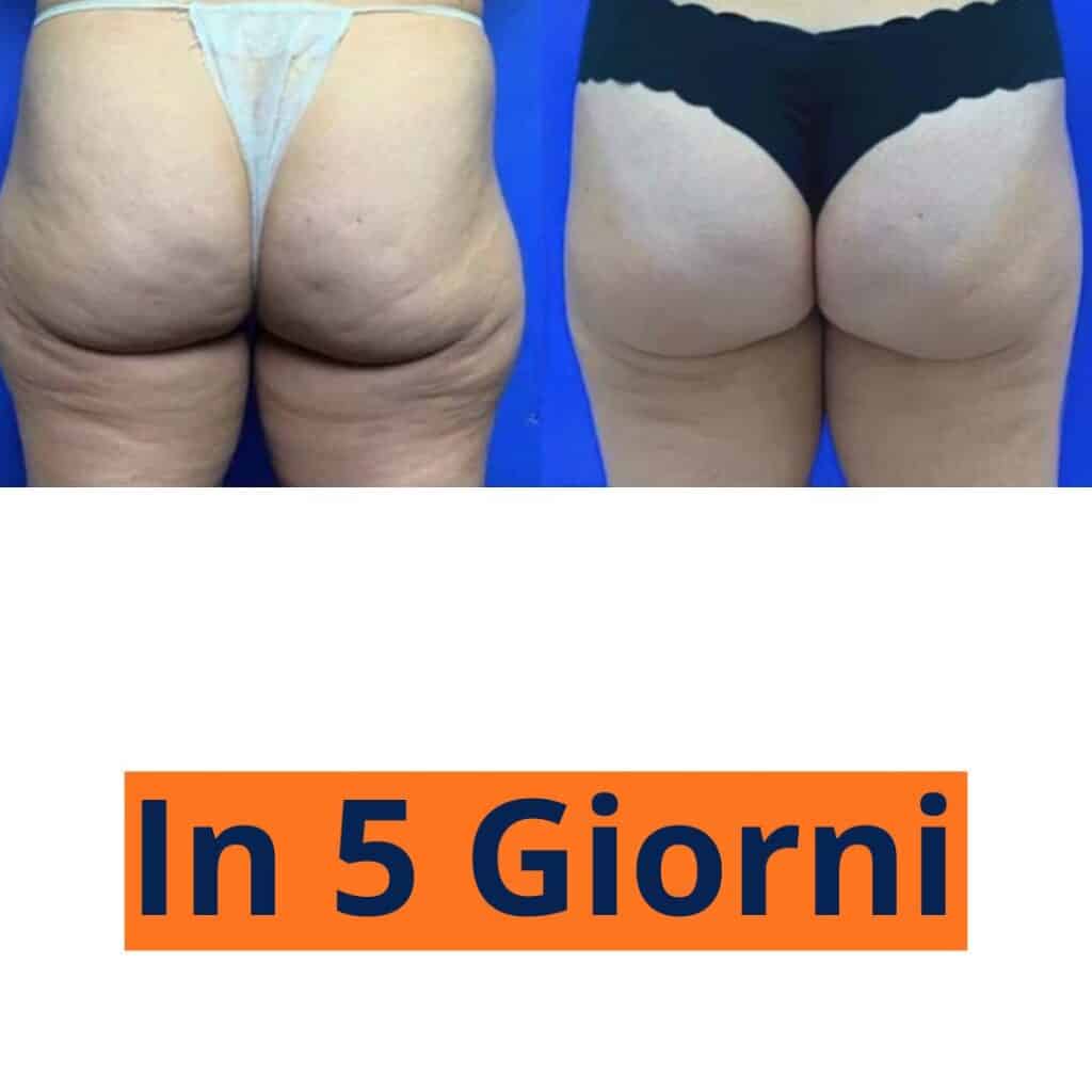 Ilarias Nutra (2)